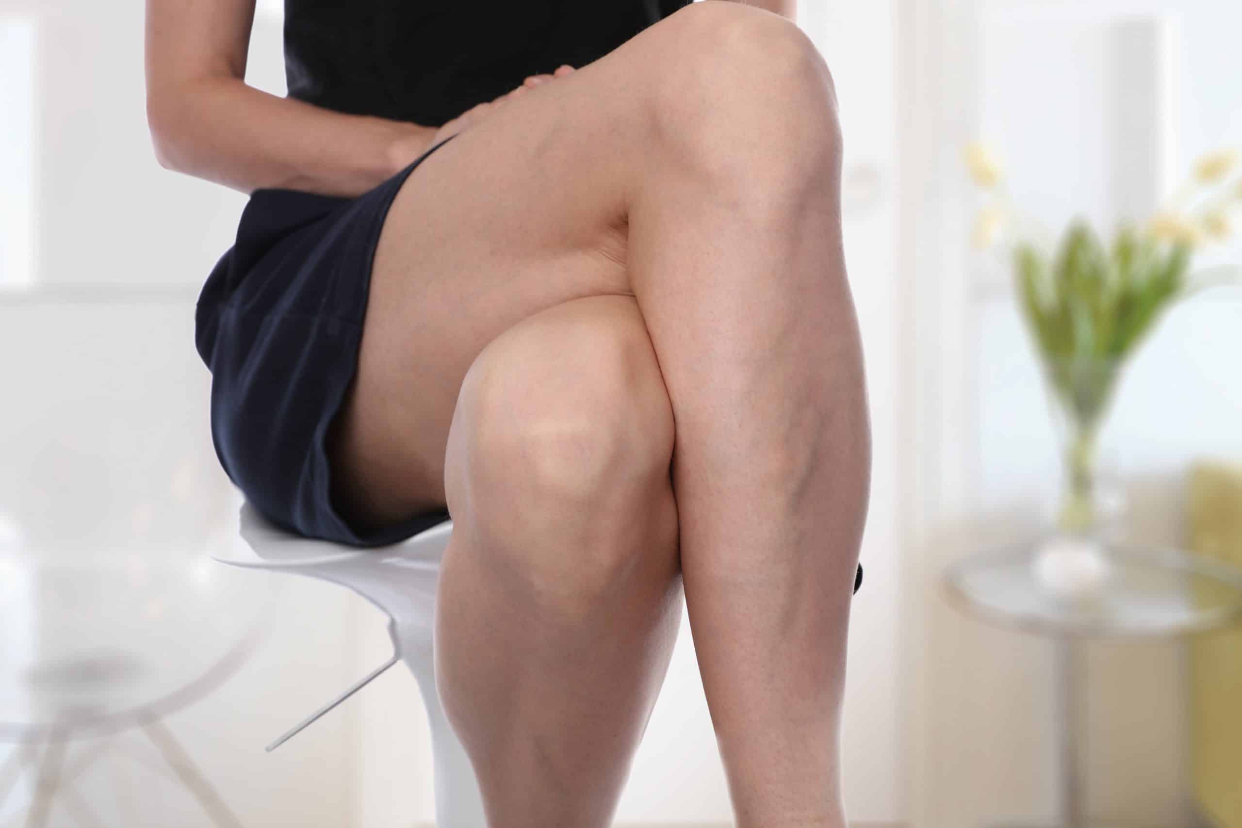 WHAT ARE SPIDER VEINS? WHAT IS THE BEST SPIDER VEIN REMOVAL?
