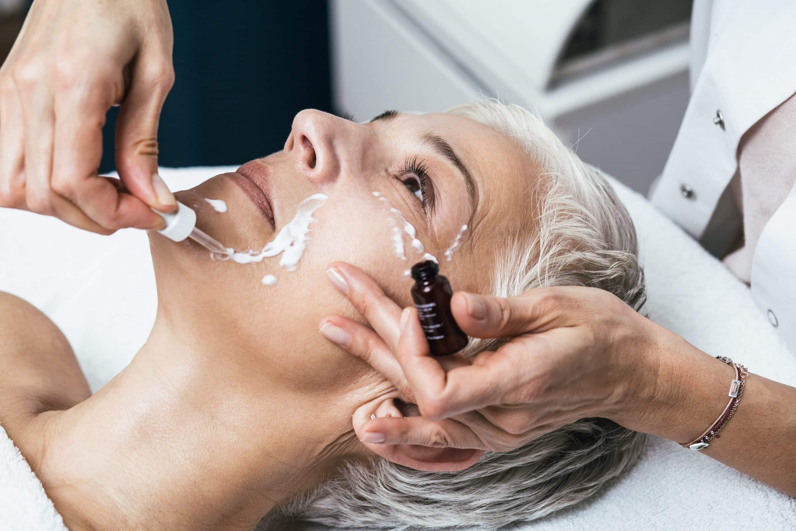 WHAT ARE THE BENEFITS OF A CHEMICAL PEEL